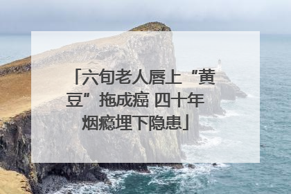 六旬老人唇上“黄豆”拖成癌 四十年烟瘾埋下隐患